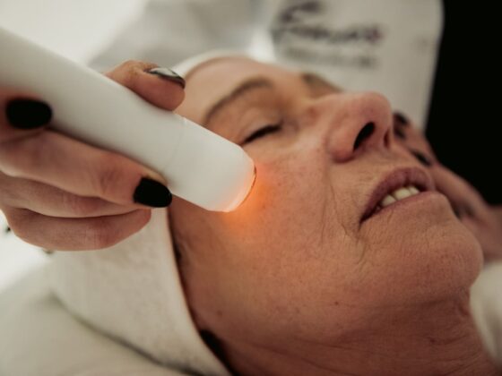 Eine Frau erhält ästhetische Behandlungen mit einem elektrischen Gerät.